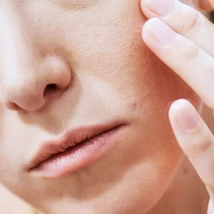 عکس حساسیت پوستی